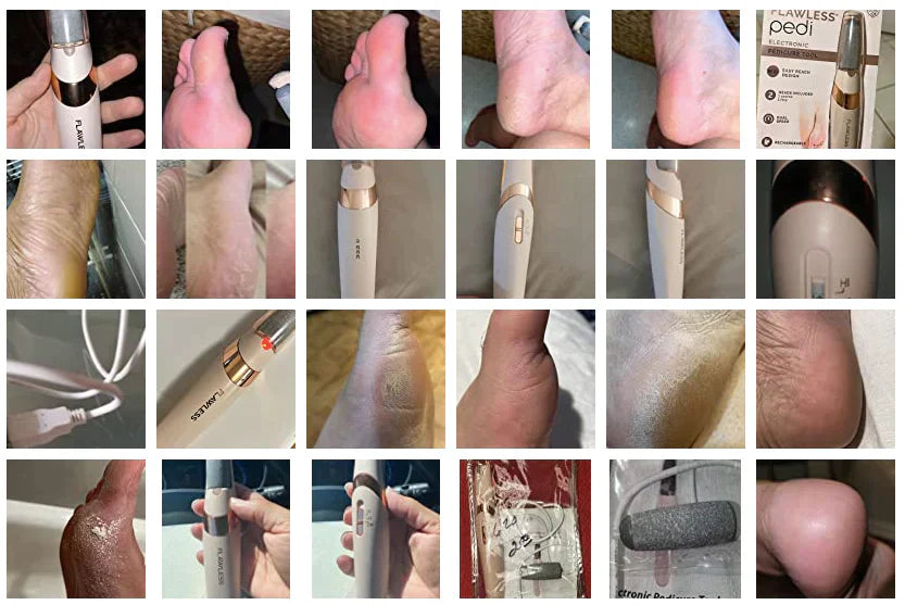 Electric foot Callus Remover